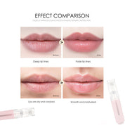 3 In 1 Lip Care Roller Needle Roller Lip My Store